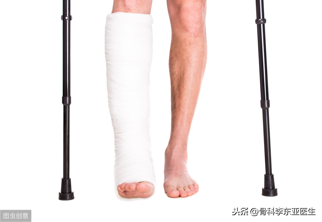 骨折的病人吃什么补钙蚂蚁庄园_骨折病人吃什么食物补钙