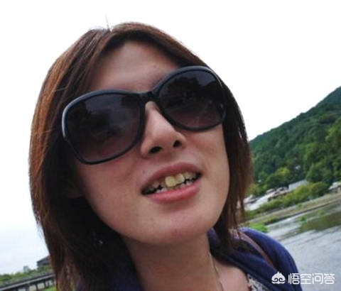 牙齿正畸仅仅是为了好看吗_牙齿正畸仅仅为了好看吗?